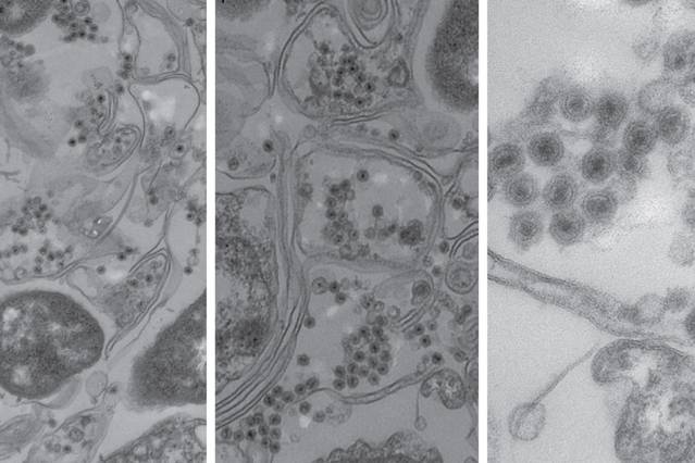 在本研究中研究的无尾病毒感染的海洋细菌的电子显微镜图像。细菌细胞壁被看作是长双线，病毒是黑色中心的小圆形物体。 （由研究人员提供）