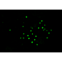 Fluorescence images of Crocosphaera (Photo: Mar Benavides)