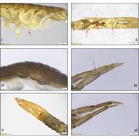 Image: Tyre particles adhered to a range of body parts of C. volutator, as visualized using a stereo microscopy (Olympus SZX16): (i) C. volutator periopods adhering tire particles in the suspension treatment (lateral view); (ii) C. volutator abdomen, gnathopods, and periopods adhering tire particles in the suspension treatment (ventral view); (iii) C. volutator periopods adhering tire particles in the surface-deposit treatment (lateral view); (iv) C. volutator 2nd antenna adhering tire particles