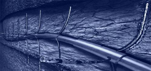 Fishbones needles (Credit: Fishbones)