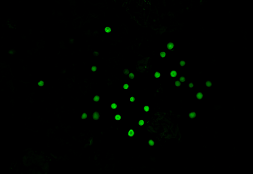 Fluorescence images of Crocosphaera (Photo: Mar Benavides)