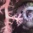 A brooding mother octopus shelters her eggs behind two different types of corals. The image was made by pilots using a robot to explore the north wall of the Mar Del Plata submarine canyon in Argentina, as part of a scientific expedition. The deepest point is over 3,500 meters – twice as deep as the Grand Canyon. The science team documented rich biodiversity, including deep-sea coral reef environments filled with sea anemones, sea cucumbers, sea urchins, snails, and others.
Image courtesy Schmid