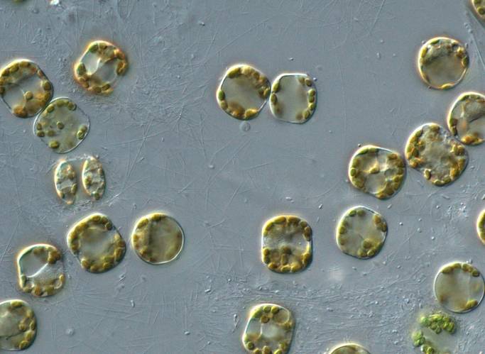 A diatom agglomeration documented and studied on Research Vessel Falkor (too) during the expedition.
Credit:  Peter von Dassow (Pontificia Universidad Católica de Chile) via Schmidt Ocean Institute
