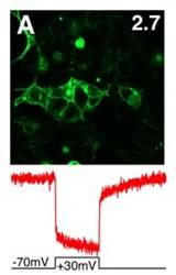 Fluorescent proteins, when attached to human cells, light up in the brain (Vincent Pieribone’sImage courtesy of the National Center for Biotechnology Information (NCBI) – PubMed)