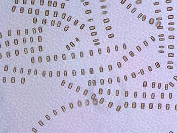 The researchers observed two species of chain-forming diatoms—Skeletonema spp. and Thalassiosira rotula (shown above)—coexisting in the same parcel of water, but doing fundamentally different things with available nutrients, specifically nitrogen and phosphorus. (Courtesy of Tatiana Rynearson, University of Rhode Island)
