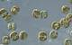 A diatom agglomeration documented and studied on Research Vessel Falkor (too) during the expedition.
Credit:  Peter von Dassow (Pontificia Universidad Católica de Chile) via Schmidt Ocean Institute
